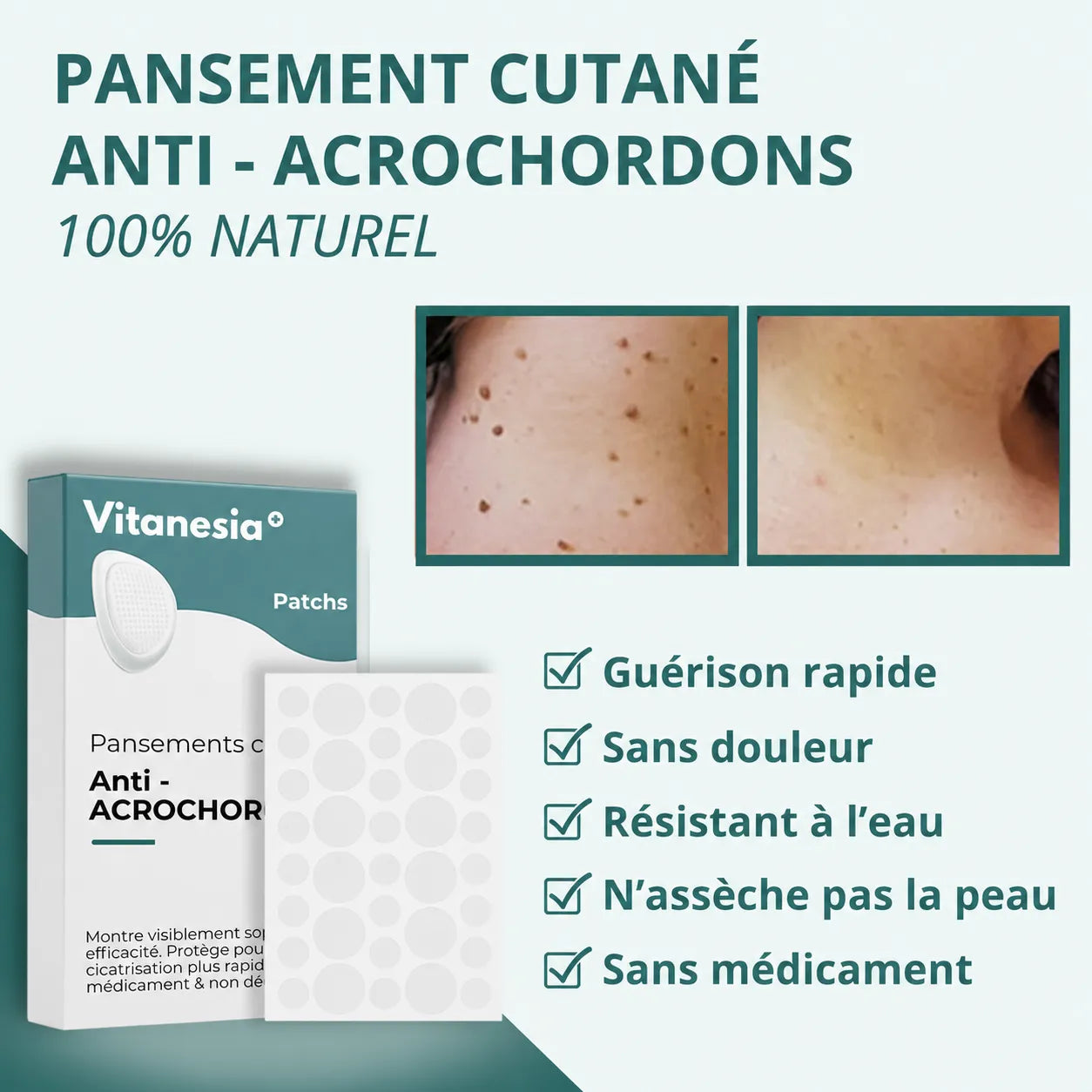 Vitanesia™ Pro Acrochordons Patch Cutané + Aloe Vera